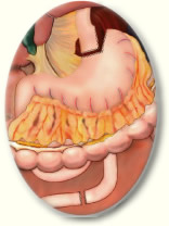 Dividing the Stomach